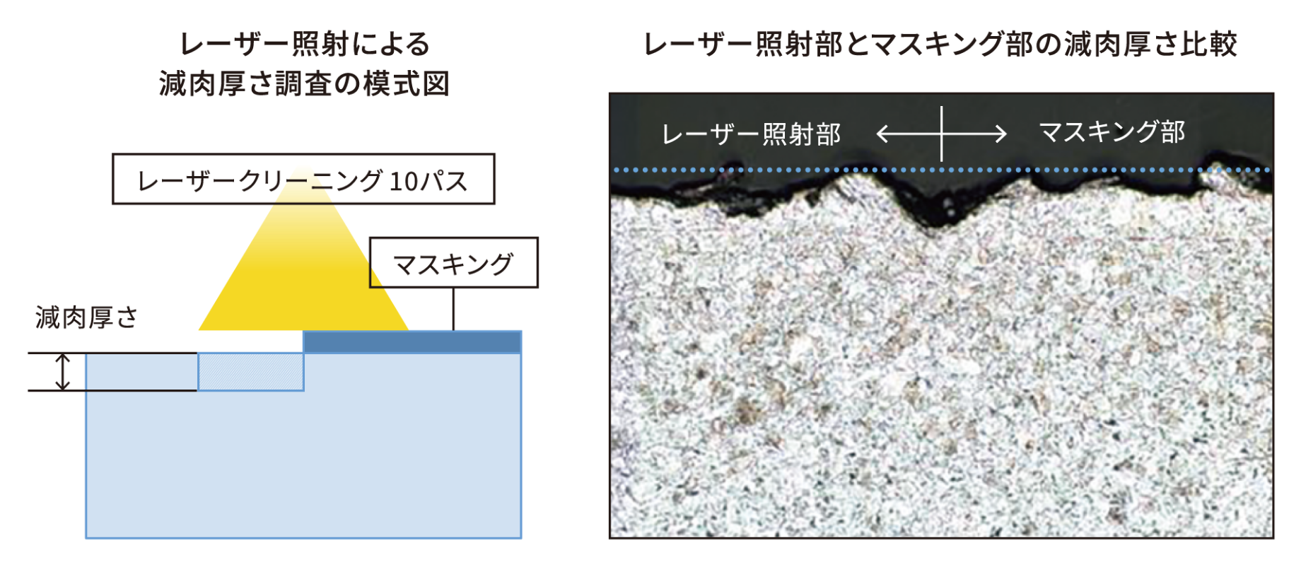 レーザー照射によるアンカーパターンへの影響